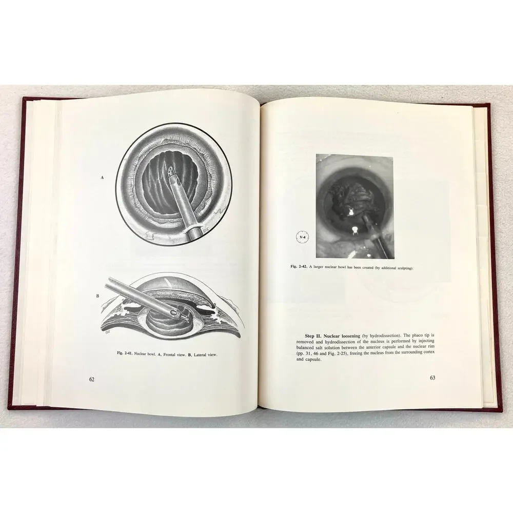 The Stereoatlas of Phacoemulsification and IOL Implantion Vintage 1990